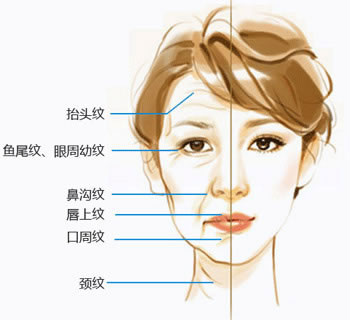 若问【脸上皱纹怎么去除】我知道啊_法令纹怎么消除我