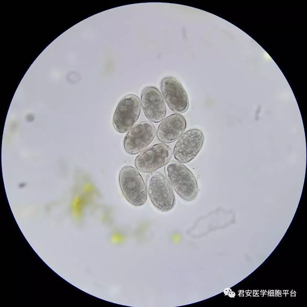 钩虫卵 饱和盐水浮聚法 图片由段爱军老师提供 第一张 钩虫的病原学