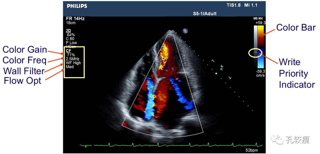 初学者如何打出漂亮的心脏超声图像