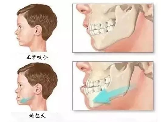 越看自己越丑怎么办