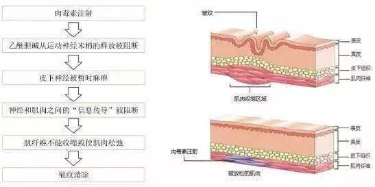 治疗原理是什么意思_根管治疗是什么意思