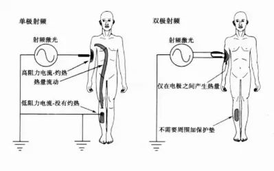 热拉提的原理_抗衰紧肤美容仪器好用吗 绿美涵 惠州抗衰紧肤美容仪器(3)