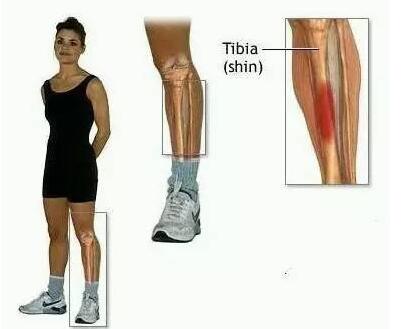 跑步后小腿疼痛?辨别不同损伤症状对应处理