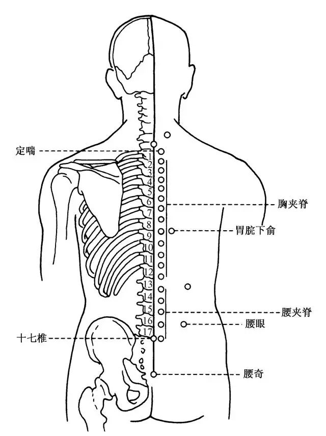 成语十什么如椎_成语故事简笔画(3)