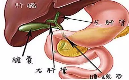 主要症状: 急性胆囊炎表现为右上腹疼痛,并向右腰背部放射,同时还可