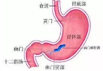 幽门螺杆菌,是生存于胃和十二指肠球部,呈现螺旋形的传染病菌, 是唯一