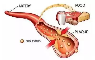 胆固醇一览表,这几种食物让胆固醇直线上升,可惜你都喜欢!