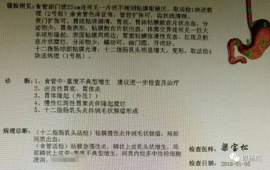 家属表示三个月前的胃镜检查,并未报告食管有任何病变!