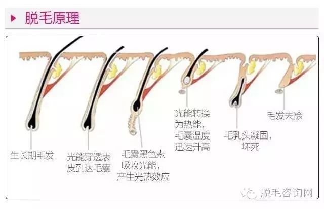 色素的原理_激光治疗色素病变原理(3)