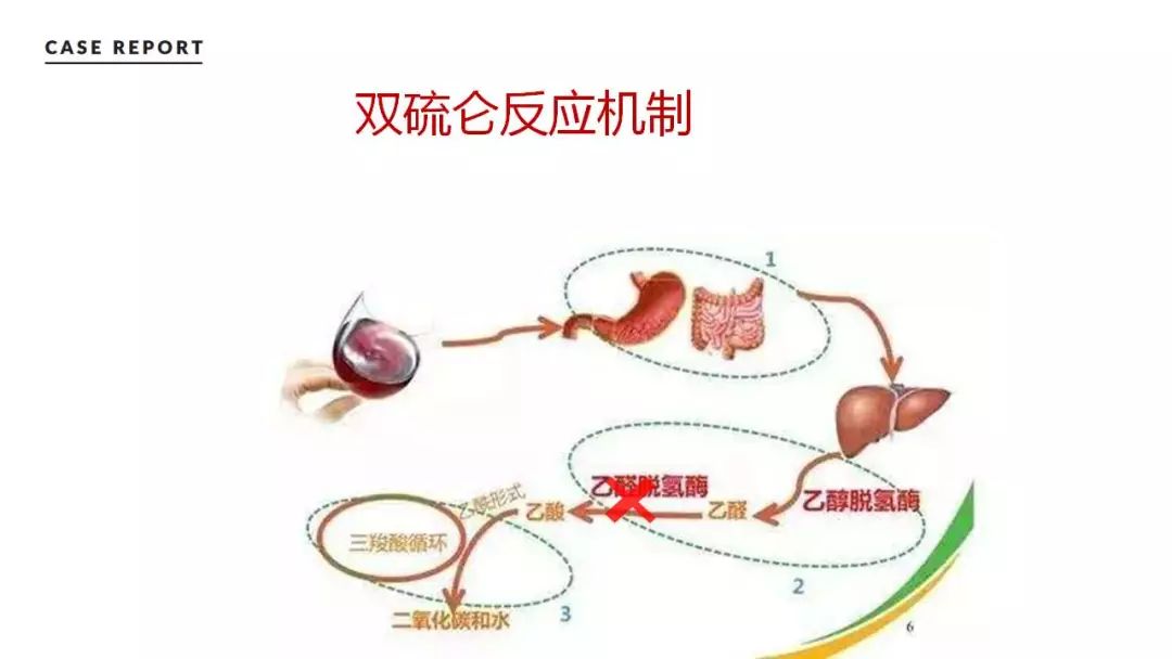 【原创】双硫仑反应病例一例