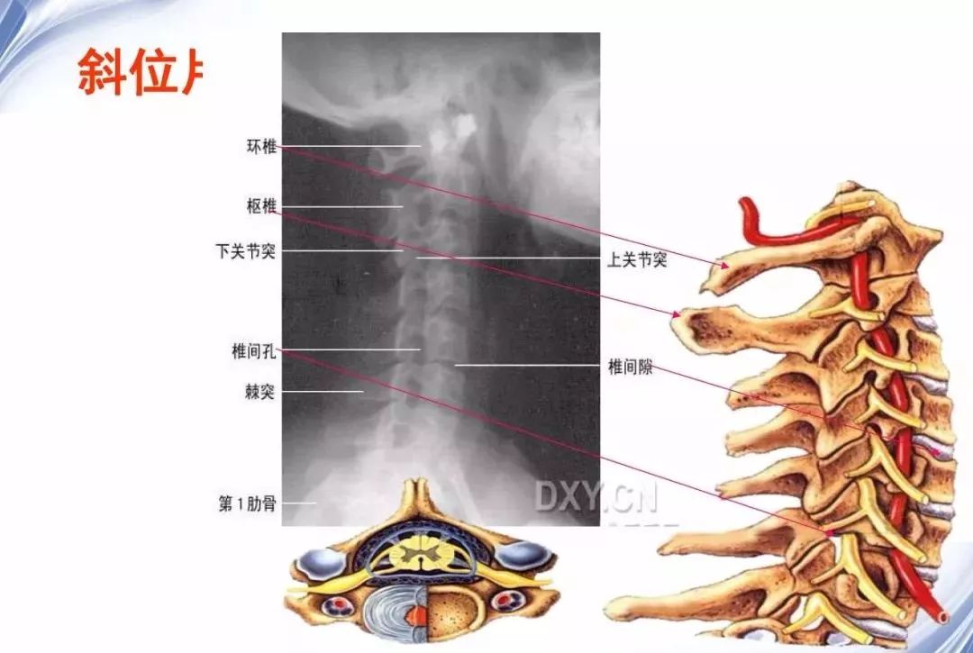 颈椎x线诊断技巧及其解读(1),建议收藏!