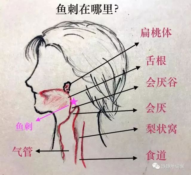 然而我陷得太深, 根本就没有挪窝. 不一会, 我的头顶出现了一道光.