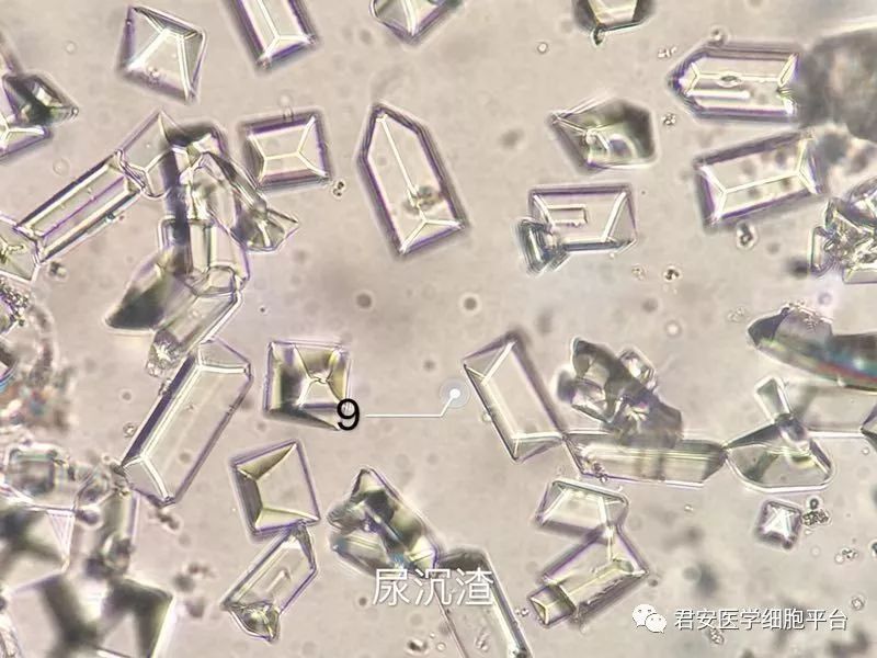 9.磷酸铵镁结晶晶体呈"棺盖"样"屋顶"样,无色,大小不一,折光性强.