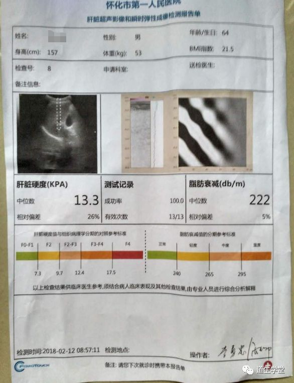 李氏砭法 | 砭法调理肝硬化