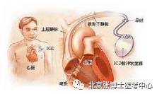 娱乐 正文  心包摩擦音音质粗糙,搔抓样,较表浅,类似纸张摩擦的声音