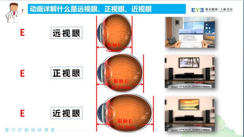 图1.远视眼,正视眼,近视眼图解