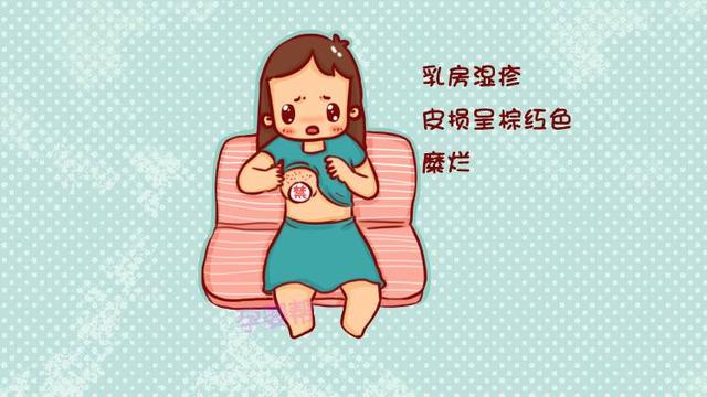 哺乳期得了乳房湿疹,还能继续喂奶吗?