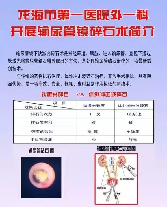 龙海市第一医院外一科输尿管镜碎石术介绍