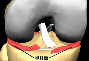 半月板可帮助力量的传递,减少股骨和胫骨间的接触压力,帮助润滑及软骨
