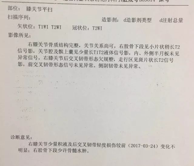 但右膝盖总是不能吃力,尤其弯曲的时候,拍了核磁诊断后交叉韧带轻伤