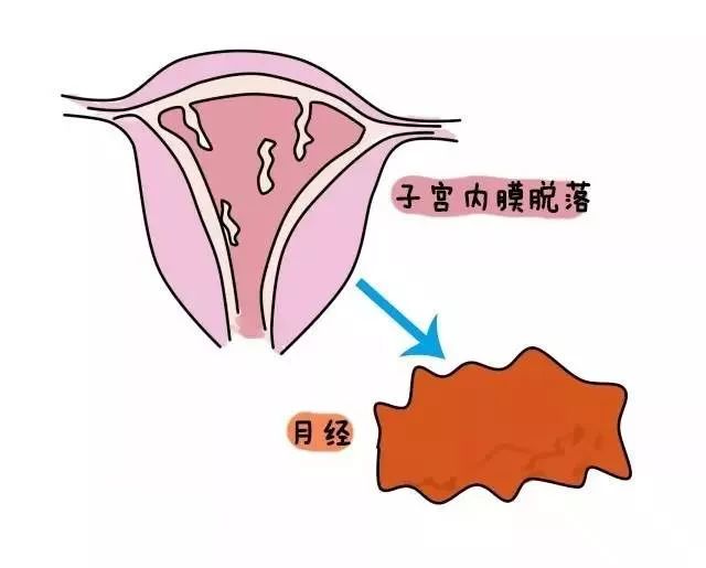 增厚的子宫内膜开始坏死而脱落,引起出血,形成月经