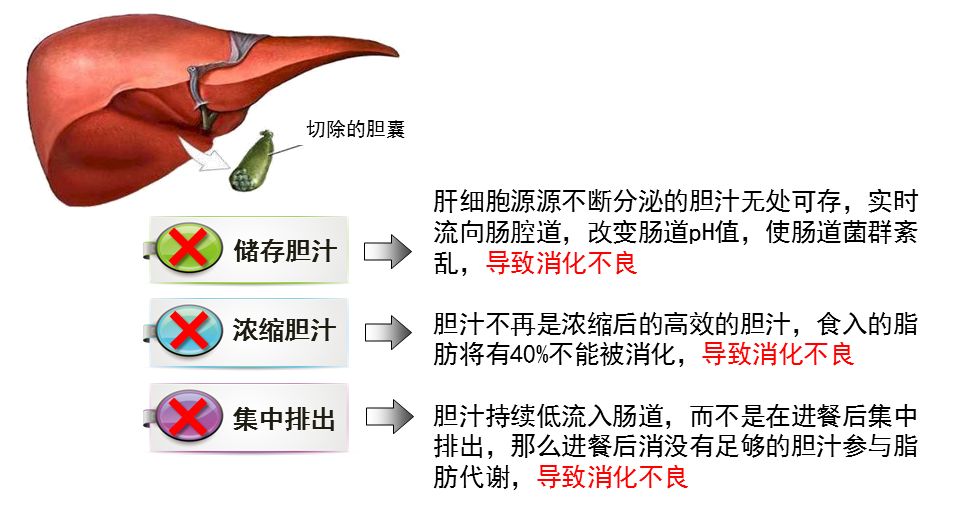 专家谈胆囊切除后到底怎么吃才科学?