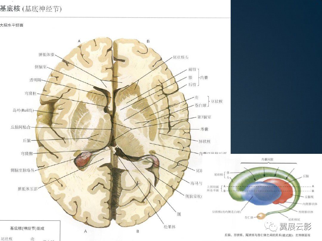 基底节区-丘脑区对称性病变总结