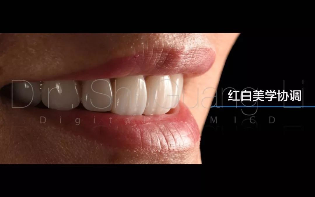 【课程邀请】前牙数字化微创美学修复系列课程