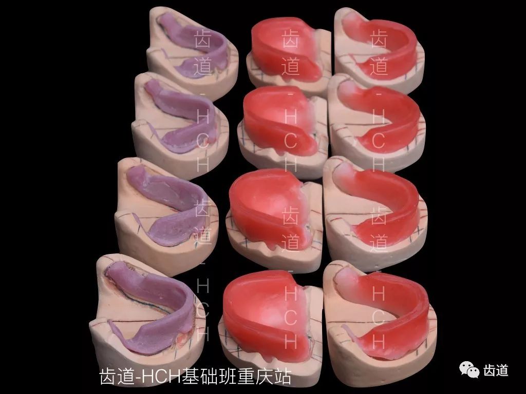齿道-hch全口义齿线下实操班学习用模型欣赏:初模,个托,终模,蜡堤