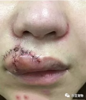 女子想和爱犬亲亲被拒,强行扳过头,结果被爱犬狂咬缝了30针!