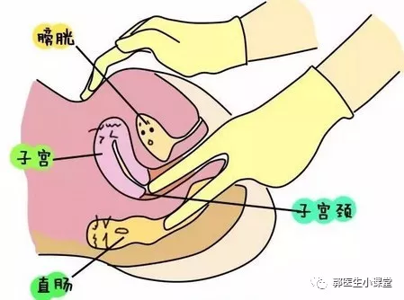 一些人认为后位子宫会影响怀孕,主要的理论依据是宫颈位置的影响.