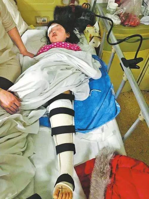 轻轻一碰"兵马俑"瞬间倾倒,宜宾一5岁小女孩被砸伤致骨折!