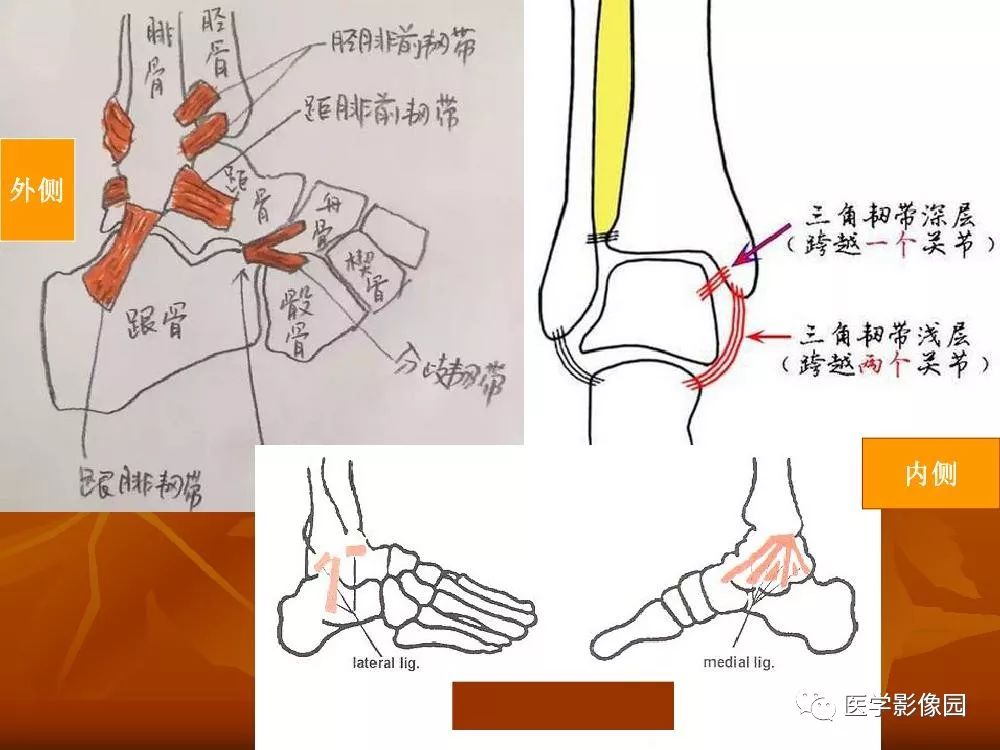 踝关节韧带的解剖及影像表现丨影像天地