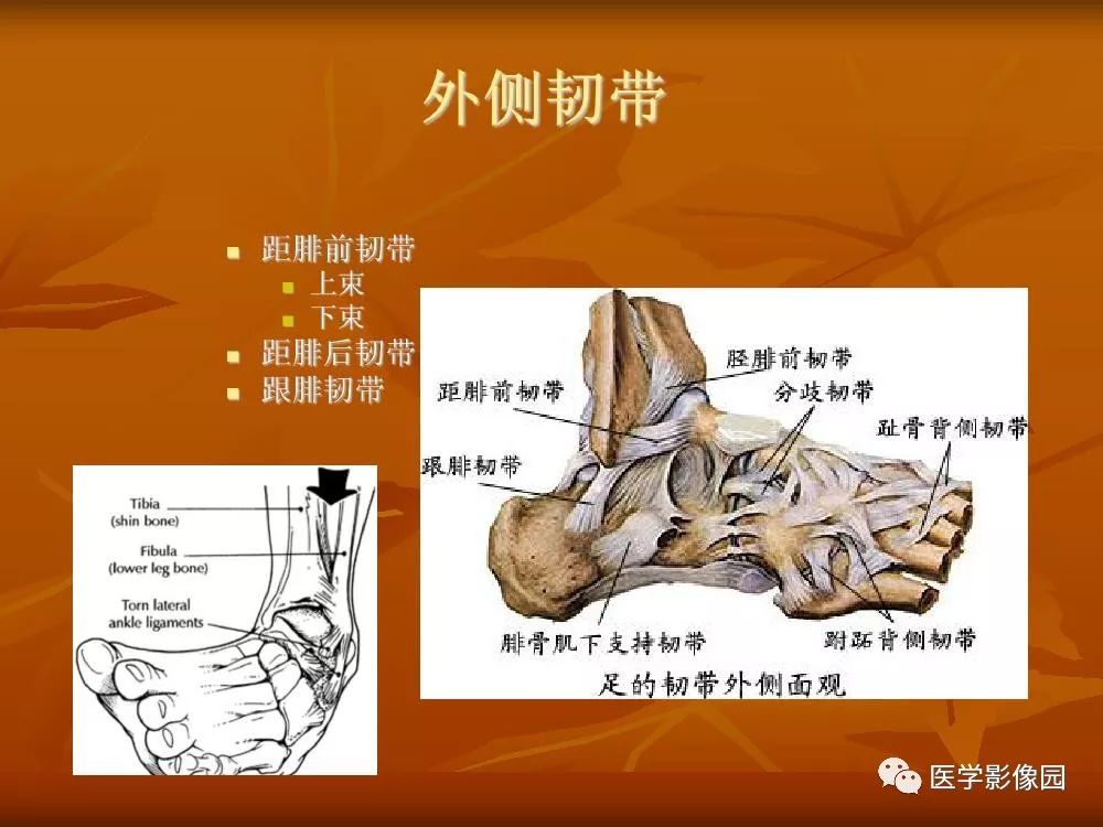 踝关节韧带的解剖及影像表现丨影像天地