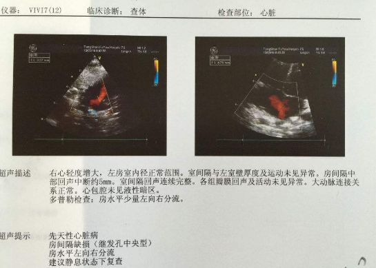 其实,心电图,心脏彩超,冠脉造影这三个检查各有用途,不能相互替代