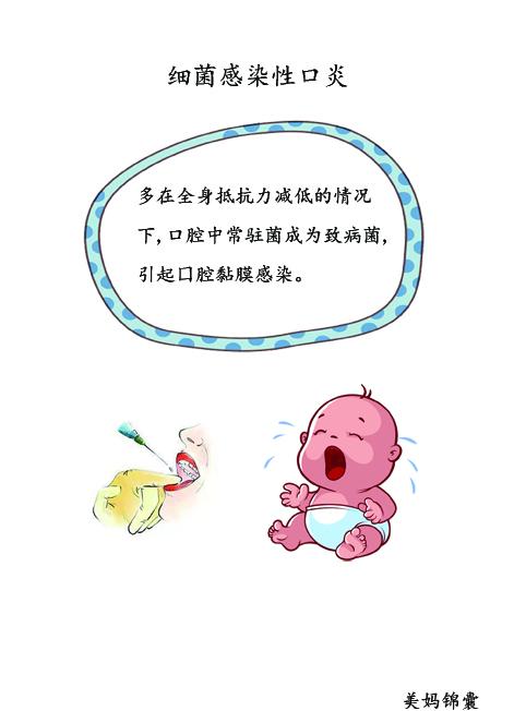 细菌感染性口炎