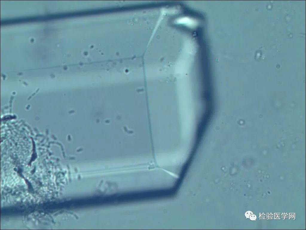 39种尿液结晶形态汇总-MedSci.cn