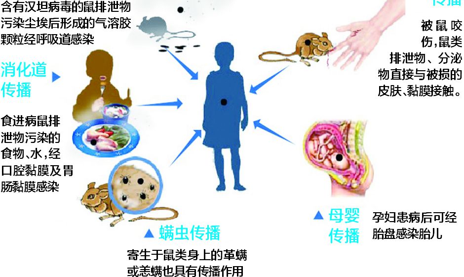 肾综合征出血热的传播途径主要分为五种: 鼠排泄物若含出血热病毒,可