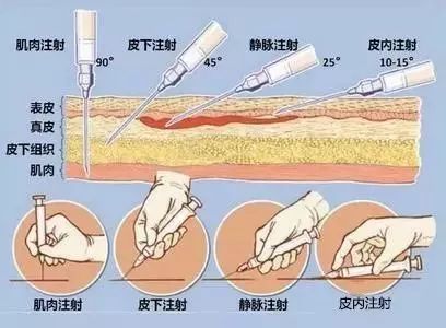 如果手背血管不清,可另选手指,手腕或手臂等地方进行注射或输液.