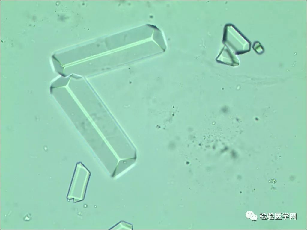 图3-5-56 非晶型磷酸盐结晶-尿液沉渣实录-医学