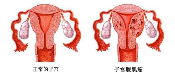 优贝海外:全面解析影响泰国试管婴儿胚胎着床率的因素