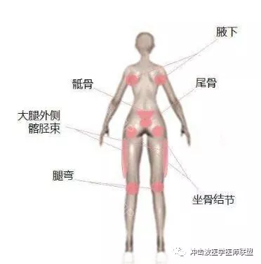 冲击波骨科治疗仪治疗坐骨结节软组织损伤的研究