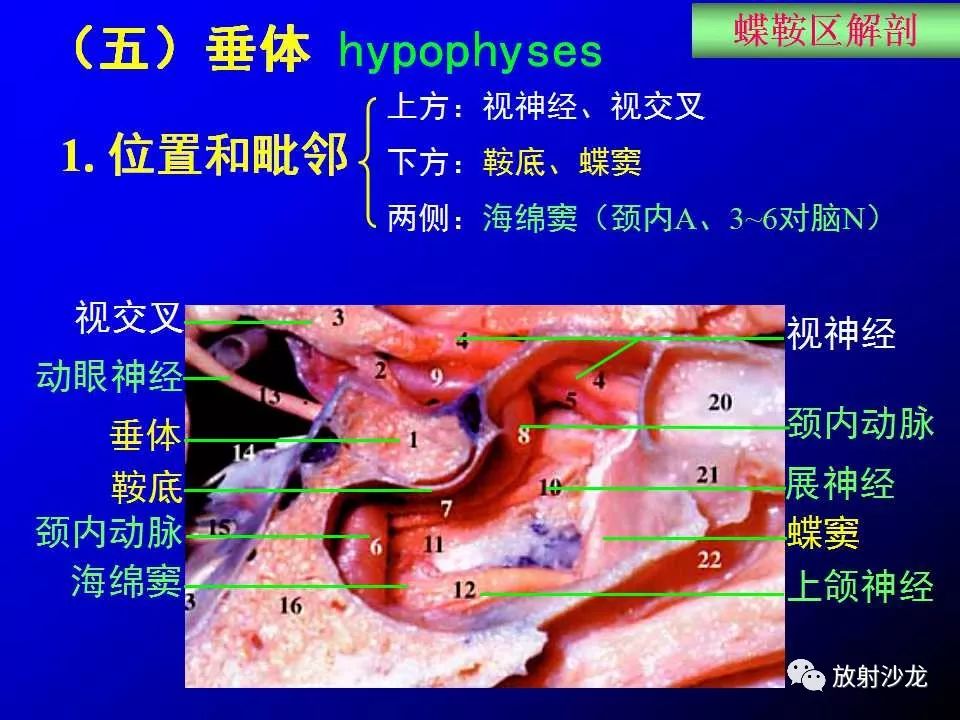 蝶鞍区解剖及疾病的影像解剖