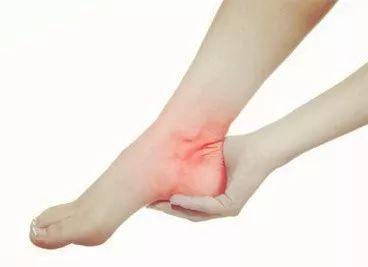 足跟痛常表现为一侧或两侧疼痛,不红不肿,休息后缓解,或运动后加重