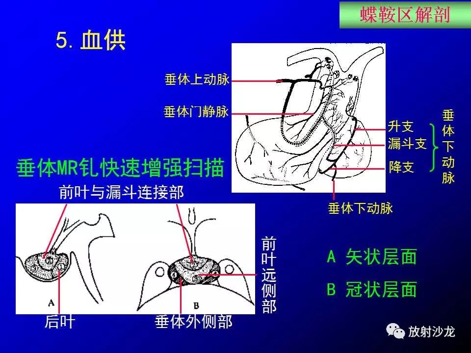 蝶鞍区解剖及疾病的影像解剖