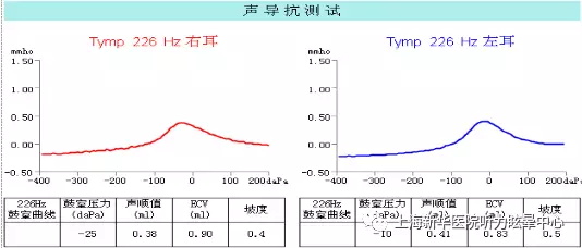 健康 正文  行为测听在低频区虽然出现明显的骨-气导差值,但声导抗