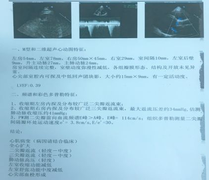 图2:病例一患者d18超声心动图报告(点击查看大图) 图3:病例一患者随访