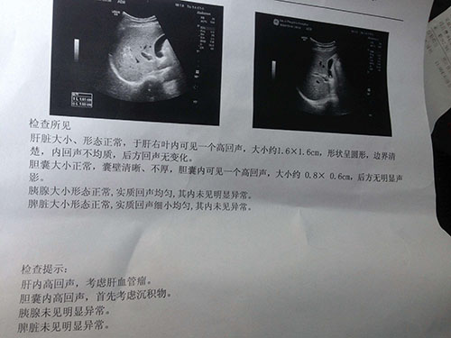 母亲检查出肝脏血管瘤, 是良性的, 有什么好的治疗方法呢?