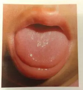 所以日常要养成多看看舌苔,五脏病症都可看舌苔,中医把舌头分为舌尖