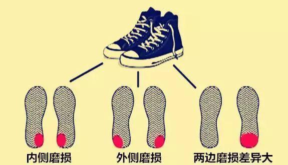 你或许会发现鞋底存在不同程度的磨损,专家认为鞋底的磨损程度反映